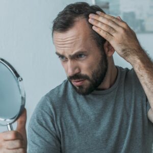 Hair Loss for Men